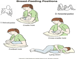D- Horizontal position
 