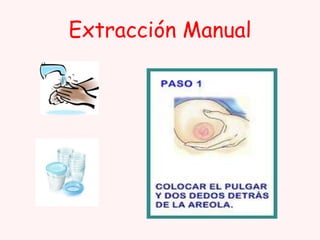 Extracción Manual

 