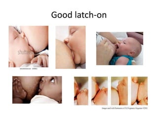 Good latch-on
 