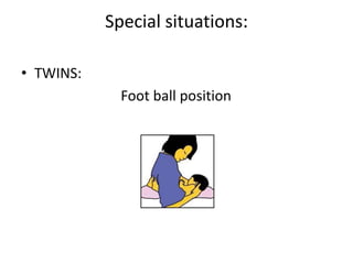 Special situations:
• TWINS:
Foot ball position
 
