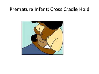 Premature Infant: Cross Cradle Hold
 