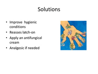 Solutions
• Improve hygienic
conditions
• Reasses latch-on
• Apply an antifungical
cream
• Analgesic if needed
 