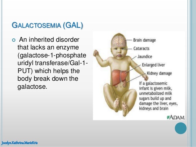 Breastfeeding Newborn Screening