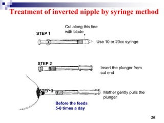26
Treatment of inverted nipple by syringe method
STEP 1
STEP 3
STEP 2
Cut along this line
with blade
Mother gently pulls the
plunger
Insert the plunger from
cut end
Use 10 or 20cc syringe
Before the feeds
5-8 times a day
 