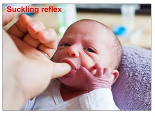 Suckling reflex
 