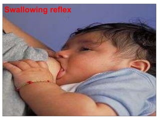 Swallowing reflex
 