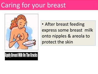 Caring for your breast
• After breast feeding
express some breast milk
onto nipples & areola to
protect the skin
 