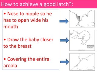 How to achieve a good latch?:
• Nose to nipple so he
has to open wide his
mouth
• Draw the baby closer
to the breast
• Covering the entire
areola
 