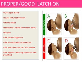 PROPER/GOOD LATCH ON
• Wide open mouth
• Lower lip turned outward
• Chin to breast
• More areola visible above than below
• No pain
• The lip are flanged out.
• The breast looked full and round
• Can hear the sound suck and swallow
• The nipple looked long and round after
breastfeed.
 