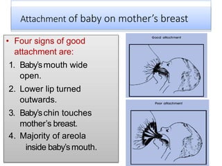 Attachment of baby on mother’s breast
• Four signs of good
attachment are:
1. Baby’smouth wide
open.
2. Lower lip turned
outwards.
3. Baby’schin touches
mother’s breast.
4. Majority of areola
inside baby’smouth.
 