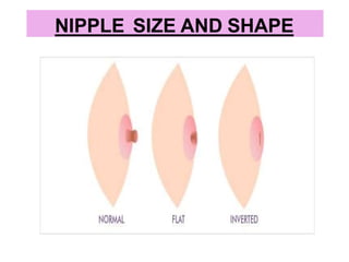 NIPPLE SIZE AND SHAPE
 