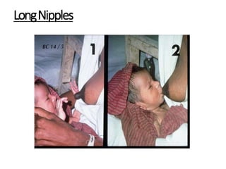 LongNipples
 