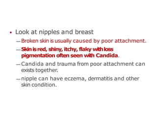 • Look at nipples and breast
— Broken skin is usually caused by poor attachment.
— Skinisred, shiny,itchy, flaky withloss
pigmentation often seen with Candida.
— Candida and trauma from poor attachment can
exists together.
— nipple can have eczema, dermatitis and other
skin condition.
 
