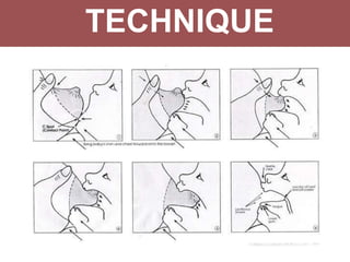 TECHNIQUE
 