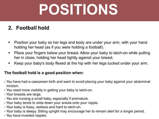 2. Football hold
 Position your baby so her legs and body are under your arm, with your hand
holding her head (as if you were holding a football).
 Place your fingers below your breast. Allow your baby to latch-on while pulling
her in close, holding her head tightly against your breast.
 Keep your baby's body flexed at the hip with her legs tucked under your arm.
The football hold is a good position when:
- You have had a caesarean birth and want to avoid placing your baby against your abdominal
incision.
- You need more visibility in getting your baby to latch-on.
- Your breasts are large.
- You are nursing a small baby, especially if premature.
- Your baby tends to slide down your areola onto your nipple.
- Your baby is fussy, restless and hard to latch-on.
- Your baby is sleepy. Sitting upright may encourage her to remain alert for a longer period.
- You have inverted nipples.
POSITIONS
 