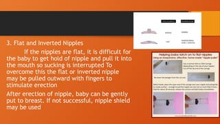 3. Flat and Inverted Nipples
If the nipples are flat, it is difficult for
the baby to get hold of nipple and pull it into
the mouth so sucking is interrupted To
overcome this the flat or inverted nipple
may be pulled outward with fingers to
stimulate erection
After erection of nipple, baby can be gently
put to breast. If not successful, nipple shield
may be used
 