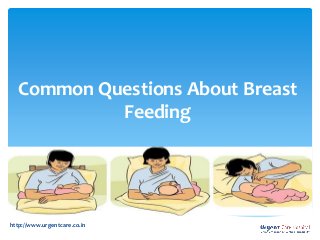 Common Questions About Breast 
Feeding 
http://www.urgentcare.co.in 
 