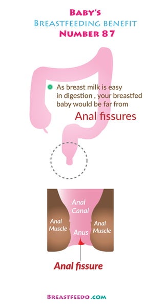 As breast milk is easy
in digestion , your breastfed
baby would be far from
Anal ﬁssures
Anal
Canal
Anal ﬁssure
Anal
Muscle
Anal
MuscleAnus
Baby’s
Breastfeeding beneﬁt
Number 87
 