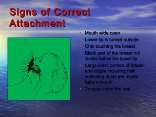 Signs of CorrectSigns of Correct
AttachmentAttachment
• Mouth wide openMouth wide open
• Lower lip is turned outsideLower lip is turned outside
• Chin touching the breastChin touching the breast
• Black part of the breast notBlack part of the breast not
visible below the lower lipvisible below the lower lip
• Large black portion of breastLarge black portion of breast
and nipple including milkand nipple including milk
collecting ducts are insidecollecting ducts are inside
baby’s mouthbaby’s mouth
• Tongue under the teatTongue under the teat
 