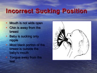 Incorrect Sucking PositionIncorrect Sucking Position
• Mouth is not wide openMouth is not wide open
• Chin is away from theChin is away from the
breastbreast
• Baby is sucking onlyBaby is sucking only
nipplenipple
• Most black portion of theMost black portion of the
breast is outside thebreast is outside the
baby’s mouthbaby’s mouth
• Tongue away from theTongue away from the
teatteat
 