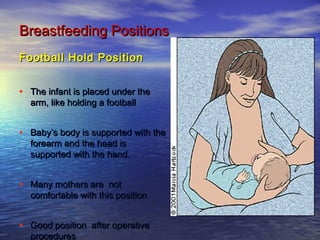 Football Hold PositionFootball Hold Position
• The infant is placed under theThe infant is placed under the
arm, like holding a footballarm, like holding a football
• Baby’s body is supported with theBaby’s body is supported with the
forearm and the head isforearm and the head is
supported with the hand.supported with the hand.
• Many mothers are notMany mothers are not
comfortable with this positioncomfortable with this position
• Good position after operativeGood position after operative
proceduresprocedures
Breastfeeding PositionsBreastfeeding Positions
 