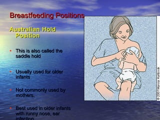 Australian HoldAustralian Hold
PositionPosition
• This is also called theThis is also called the
saddle holdsaddle hold
• Usually used for olderUsually used for older
infantsinfants
• Not commonly used byNot commonly used by
mothers.mothers.
• Best used in older infantsBest used in older infants
with runny nose, earwith runny nose, ear
Breastfeeding PositionsBreastfeeding Positions
 