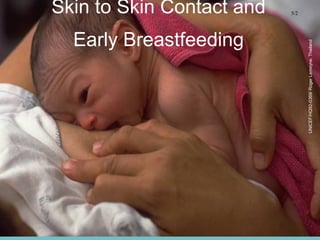 Skin to Skin Contact and
Early Breastfeeding
5/2
UNICEF/HQ92-0369/RogerLemoyne,Thailand
 