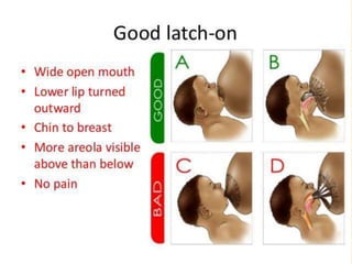 Breast feeding ppt