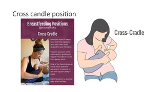 Breast feeding techniques - 2 Breast feeding.pptx