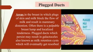 Techniques Of Breast Feeding and problems of breast feeding techniques.pptx