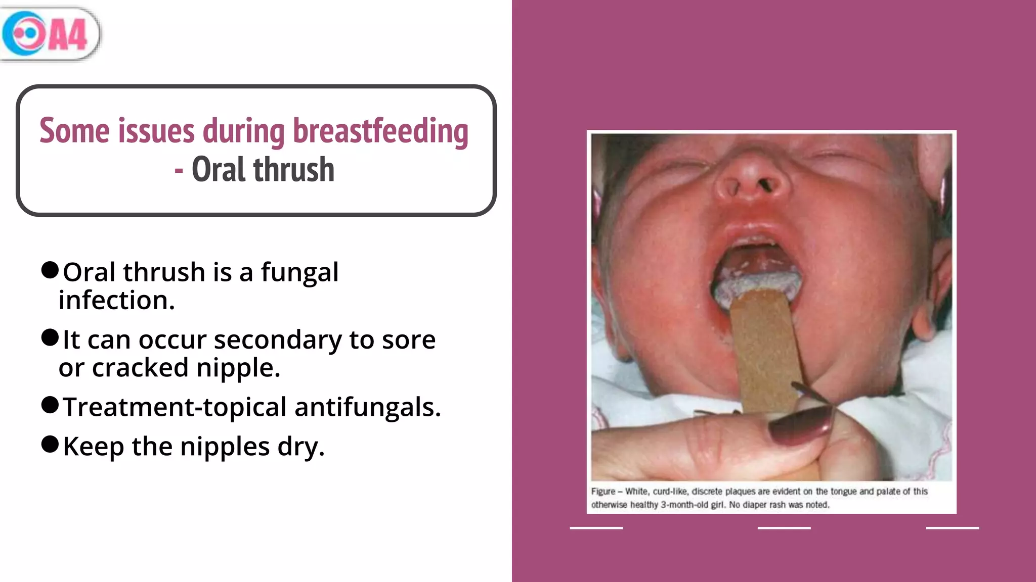 Breastfeeding tips for new moms | PPTX