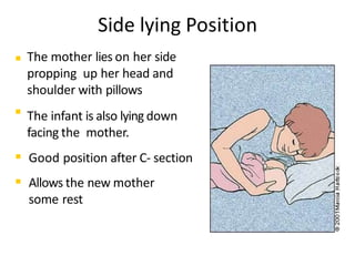  The mother lies on her side
propping up her head and
shoulder with pillows.

The infant is also lying down
facing the mother.
 Good position after C- section.
 Allows the new mother
some rest.
Side lying Position
Adapted from AAFP Journal September 2001
 