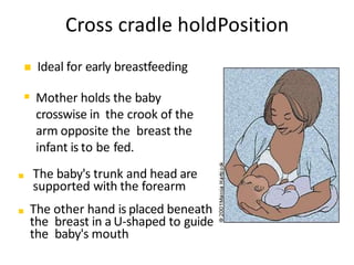  Ideal for early breastfeeding.
 Mother holds the baby
crosswise in the crook of the
arm opposite the breast the
infant is to be fed.
 The baby's trunk and head are
supported with the forearm
 The other hand is placed beneath
the breast in a U-shaped to guide
the baby's mouth
Cross cradle holdPosition
Adapted from AAFP Journal September 2001
 