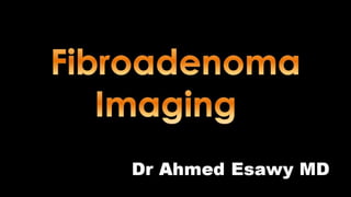 Breast fibroadenoma imaging