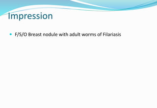 Impression
 F/S/O Breast nodule with adult worms of Filariasis
 