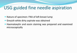 USG guided fine needle aspiration
 Nature of specimen: FNA of left breast lump
 Greyish white dirty aspirate was obtaine...