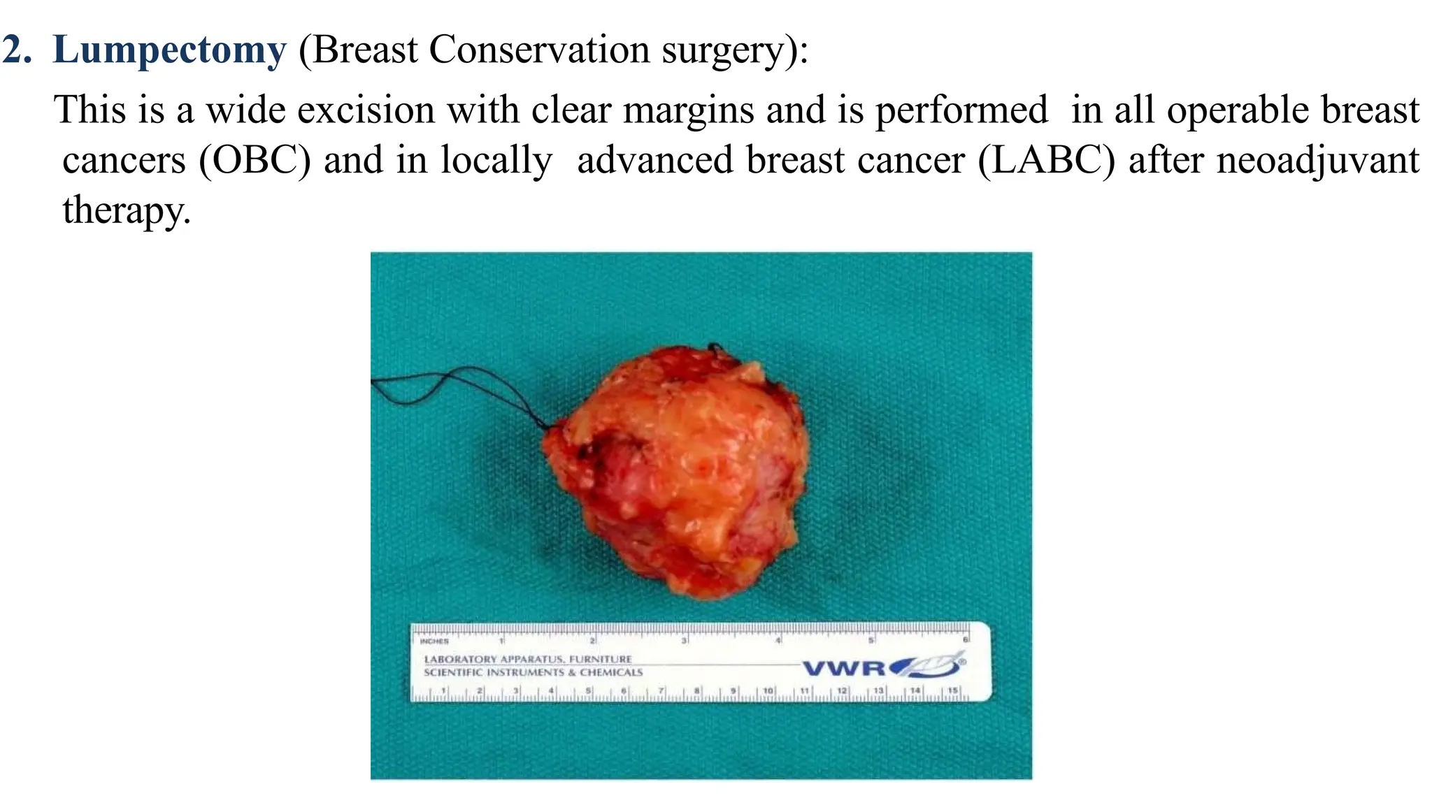 Breast Grossing For Pathology Post Graduates PPTX breast-grossing-for-pathology-post-graduates-pptx