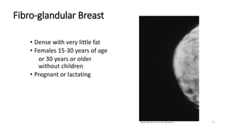 17
Fibro-glandular Breast
• Dense with very little fat
• Females 15-30 years of age
or 30 years or older
without children
• Pregnant or lactating
 