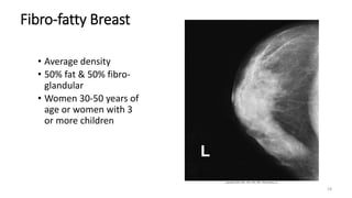 18
Fibro-fatty Breast
• Average density
• 50% fat & 50% fibro-
glandular
• Women 30-50 years of
age or women with 3
or more children
 