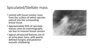 Spiculated/Stellate mass
• central soft-tissue tumour mass
from the surface of which spicules
extend into the surrounding
breast tissue
• Approximately 95% of spiculate
masses seen on mammography
are due to invasive breast cancers
• typical ultrasound features are of
an echo-poor mass, with poorly
defined margins and posterior
acoustic shadowing
 