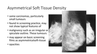 Asymmetrical Soft Tissue Density
• some carcinomas, particularly
small tumours
• found in screening practice, may
not show typical features of
• malignancy such as an irregular or
spiculate outline. These tumours
• may appear on basic screening
films as asymmetricalsoft-tissue
• opacities
 