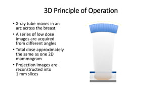 3D Principle of Operation
• X-ray tube moves in an
arc across the breast
• A series of low dose
images are acquired
from different angles
• Total dose approximately
the same as one 2D
mammogram
• Projection images are
reconstructed into
1 mm slices
Compression
Paddle
Compressed
Breast
Detector Housing
Reconstructed
Slices {
Arc of motion of x-ray tube, showing
individual exposures
 