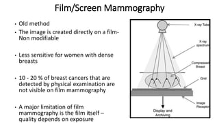 Film/Screen Mammography
• Old method
• The image is created directly on a film-
Non modifiable
• Less sensitive for women with dense
breasts
• 10 - 20 % of breast cancers that are
detected by physical examination are
not visible on film mammography
• A major limitation of film
mammography is the film itself –
quality depends on exposure
 