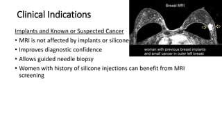 Clinical Indications
Implants and Known or Suspected Cancer
• MRI is not affected by implants or silicone
• Improves diagnostic confidence
• Allows guided needle biopsy
• Women with history of silicone injections can benefit from MRI
screening
 
