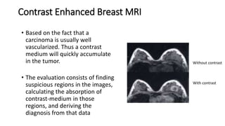 Contrast Enhanced Breast MRI
• Based on the fact that a
carcinoma is usually well
vascularized. Thus a contrast
medium will quickly accumulate
in the tumor.
• The evaluation consists of finding
suspicious regions in the images,
calculating the absorption of
contrast-medium in those
regions, and deriving the
diagnosis from that data
Without contrast
With contrast
 