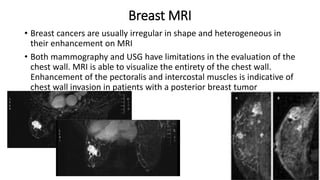 Breast MRI
• Breast cancers are usually irregular in shape and heterogeneous in
their enhancement on MRI
• Both mammography and USG have limitations in the evaluation of the
chest wall. MRI is able to visualize the entirety of the chest wall.
Enhancement of the pectoralis and intercostal muscles is indicative of
chest wall invasion in patients with a posterior breast tumor
 