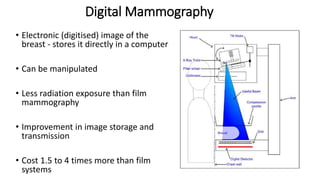Digital Mammography
• Electronic (digitised) image of the
breast - stores it directly in a computer
• Can be manipulated
• Less radiation exposure than film
mammography
• Improvement in image storage and
transmission
• Cost 1.5 to 4 times more than film
systems
 