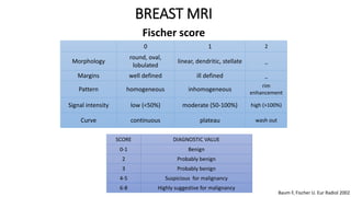 Baum F, Fischer U. Eur Radiol 2002
0 1 2
Morphology
round, oval,
lobulated
linear, dendritic, stellate _
Margins well defined ill defined _
Pattern homogeneous inhomogeneous
rim
enhancement
Signal intensity low (<50%) moderate (50-100%) high (>100%)
Curve continuous plateau wash out
SCORE DIAGNOSTIC VALUE
0-1 Benign
2 Probably benign
3 Probably benign
4-5 Suspicious for malignancy
6-8 Highly suggestive for malignancy
Fischer score
BREAST MRI
 