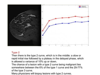 •
Type 2
Then there is the type 2 curve, which is in the middle: a slow or
rapid initial rise followed by a plateau in the delayed phase, which
is allowed a variance of 10% up or down.
The chance of a lesion with a type 2 curve being malignant lies
somewhere between the 6% of the type 1 curve and the 29-77%
of the type 3 curve.
Many physicians will biopsy lesions with type 2 curves.
 