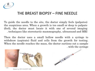 Made by DR SHARIFI MD
129
THE BREAST BIOPSY – FINE NEEDLE
To guide the needle to the site, the doctor simply feels (palpates)
the suspicious area. When a growth is too small or deep to palpate
(feel), the doctor must locate it with one of several imaging
techniques like stereotactic mammography, ultrasound and MRI.
Then the doctor uses a small hollow needle with a syringe to
withdraw (aspirate) fluid and cells from the growth for testing.
When the needle reaches the mass, the doctor suctions out a sample
with the syringe.
 
